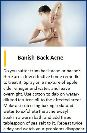 back acne solution
