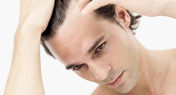 baldness is curable, find out how